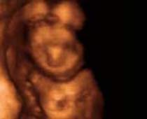 Échographie 4D vieux 18 semaines foetus