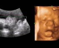 Échographie 4D une alimentation fœtus