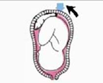 Video process of Labour (delivery) and how uterine contractions are initiated
