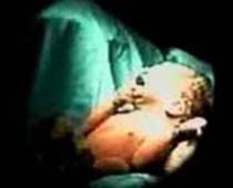 فيديو الولادة الطبيعية - المرحلة الثانية من الولادة