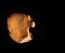 3D Ultrasound of Fetal Face clip 1