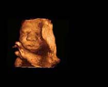Échographie 3D de clip visage fœtal 5