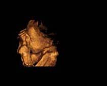 Échographie 3D de Second Trimestre foetus 6