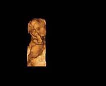Échographie 3D de foetus chant