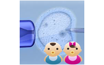 In Vitro Fertilization - I.V.F