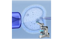 Intracytoplasmic Sperm Injection - Indications - Techniques and Applications - ICSI