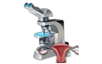 Hysteroscopy - Hysteroscopy for Infertility