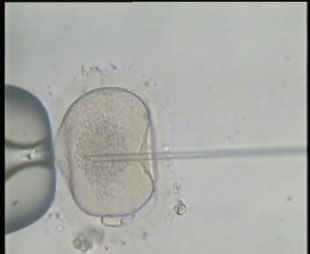 IVF and ICSI Photos 1