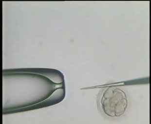 IVF and ICSI Photos 3