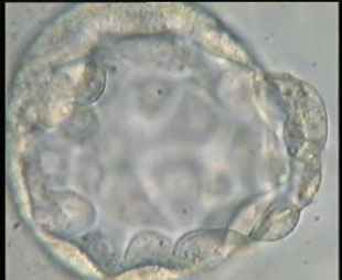 IVF and ICSI Photos 5