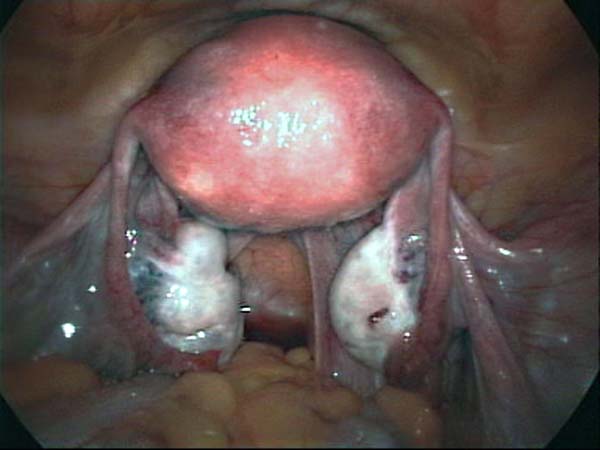 female internal genital system