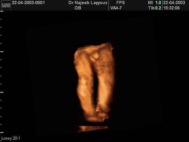 Lower limbs 22 weeks