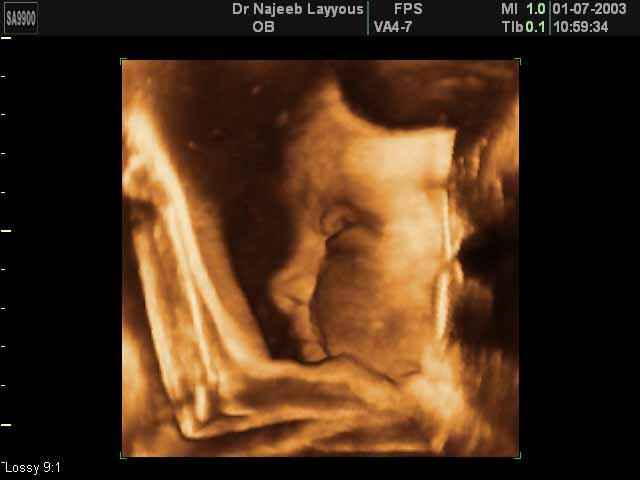 fetal profile