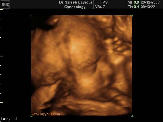 fetal profile