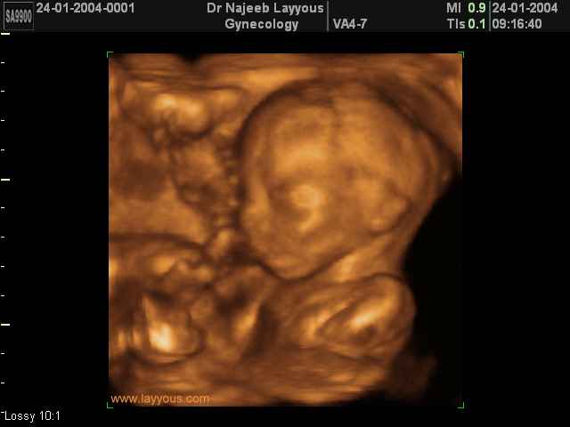 fetal profile