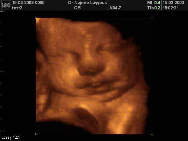 صورة وجه الجنين