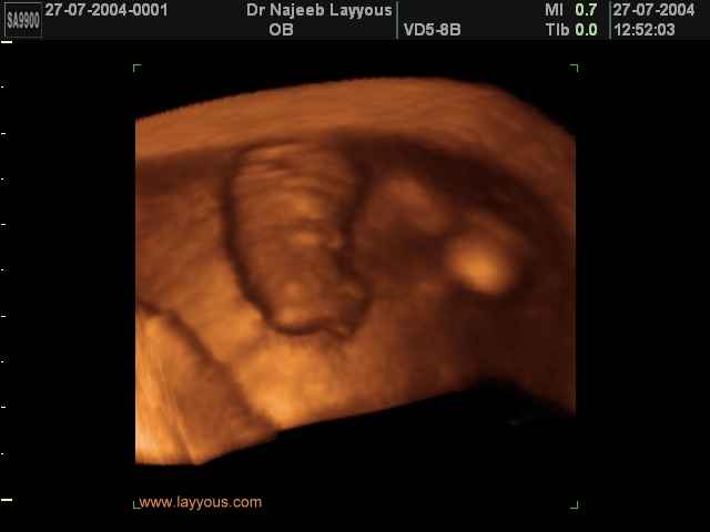 First Trimester Photos