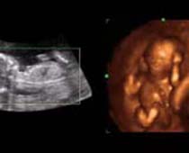4D Ultrasound a fetus Relaxing ( Baby Relaxing )