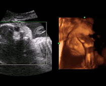 Échographie 4D d'un vieux 27 semaines de clip fœtus 2