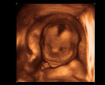 Échographie 4D d'un vieux 27 semaines foetus 27 semaines de grossesse