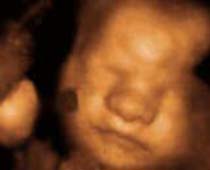 4D ultrasons expressions du visage d'un fetus.clip 3