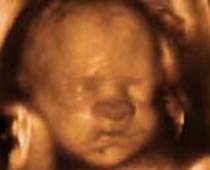 4D ultrasons expressions du visage d'un fœtus 1