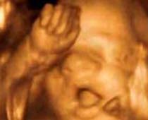 4D Ultrasound a fetus attempting Early Communication