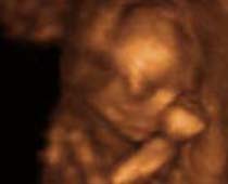 Échographie 4D un fœtus ayant un repos