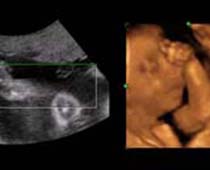 Échographie 4D une belle vue sur les mains fœtales