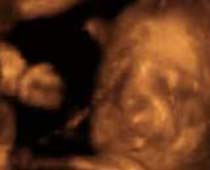 Échographie 4D un bâillement fœtus
