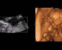 4D Ultrasound a fetus Just Sitting