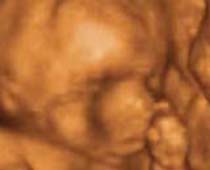 Échographie 4D une signalisation fœtus