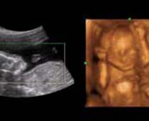 Échographie 4D un fœtus qui veut savoir ce qui se passe