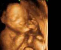 4D ultrasons une Méditer fœtus
