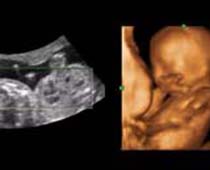 4D Ultrasound an Amazed Baby