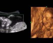 4D Ultrasound a Fetus Trying to Get Attention