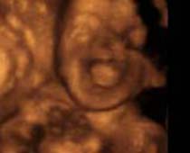 4D Ultrasound a fetus shouting clip 2