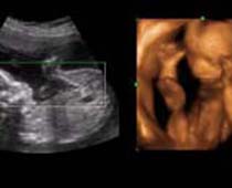 4D Ultrasound a fetus showing his bits( I am a boy )