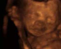 4D Ultrasound a fetus thinking-fetus having some thoughts