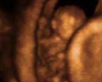 Échographie 4D fœtus montrer (je peux faire des choses)