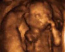 4D Ultrasound a fetus Turning Around