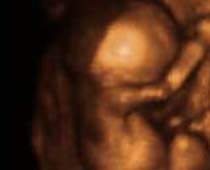 Échographie 4D belle vue de côté d'un fœtus
