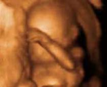 4D Ultrasound a fetus Hiding his Face clip 1