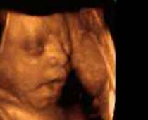 Échographie 4D un bâillement fœtus (bébé bâillement), coupent pas 4