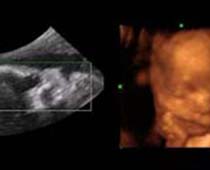 Échographie 4D un foetus qui ne sait pas quoi faire avec lui-même
