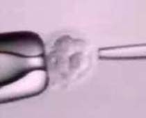 Biopsie d'embryon