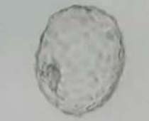 Video Hatched blastocyst showing the empty zona with few blastomeres were not compacted