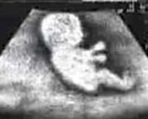 Humorous Ultrasound Video Clip of Fetus driving
