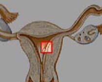 La fertilisation et l'Implantation de l'Embryon