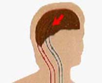 Video describing Response to a Sexual Stimulus depends on the presence of sex hormones